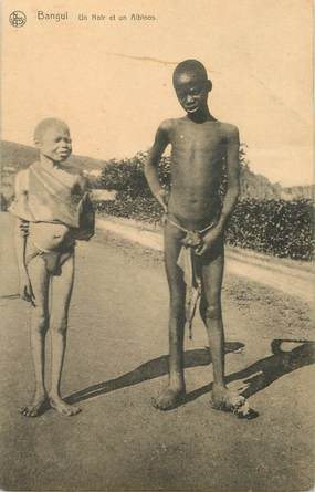 CPA REPUBLIQUE CENTRAFRICAINE " BANGUI, un noir et un albinos"